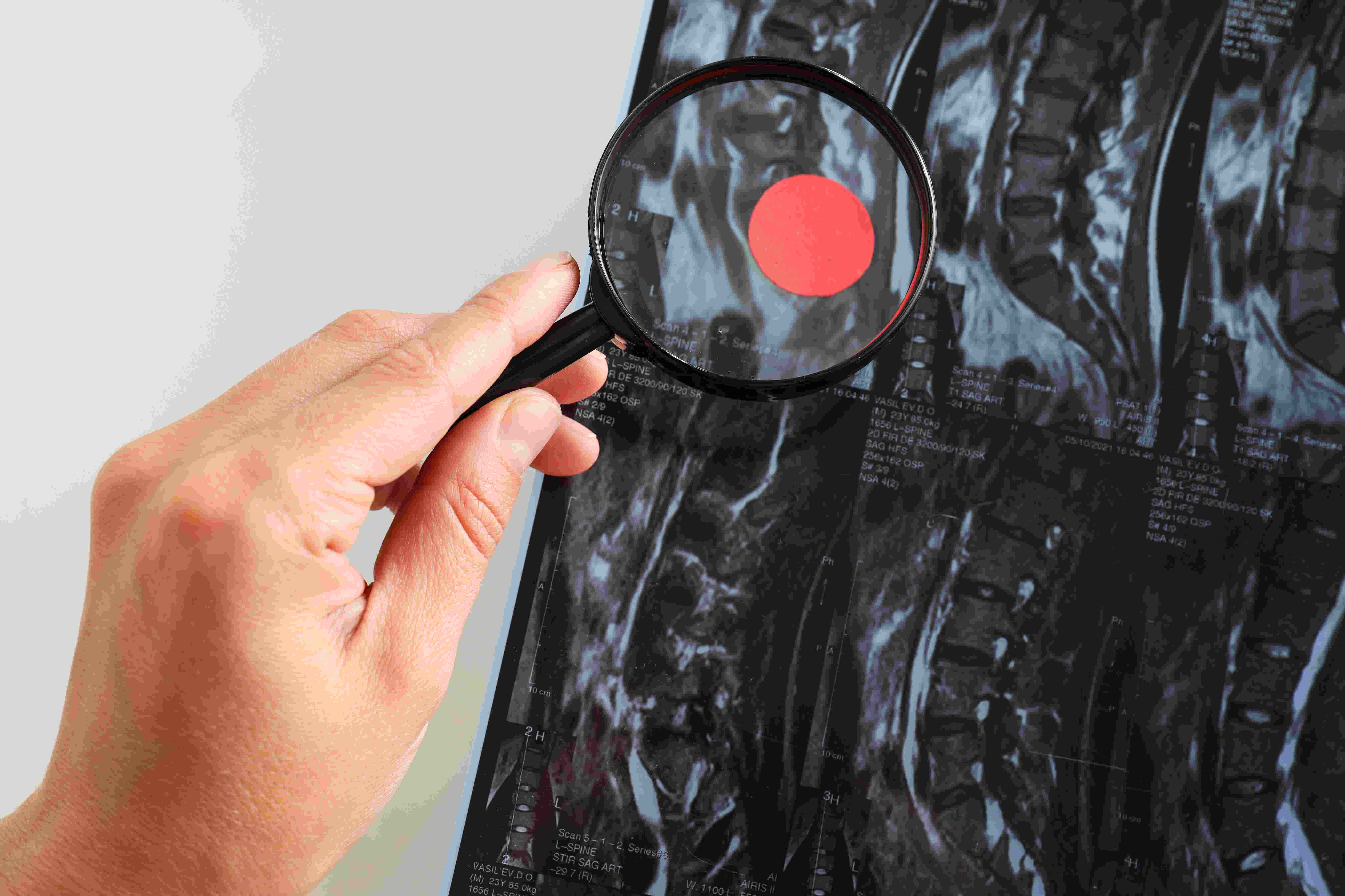 Omurga cerrahisi tanı yöntemleri