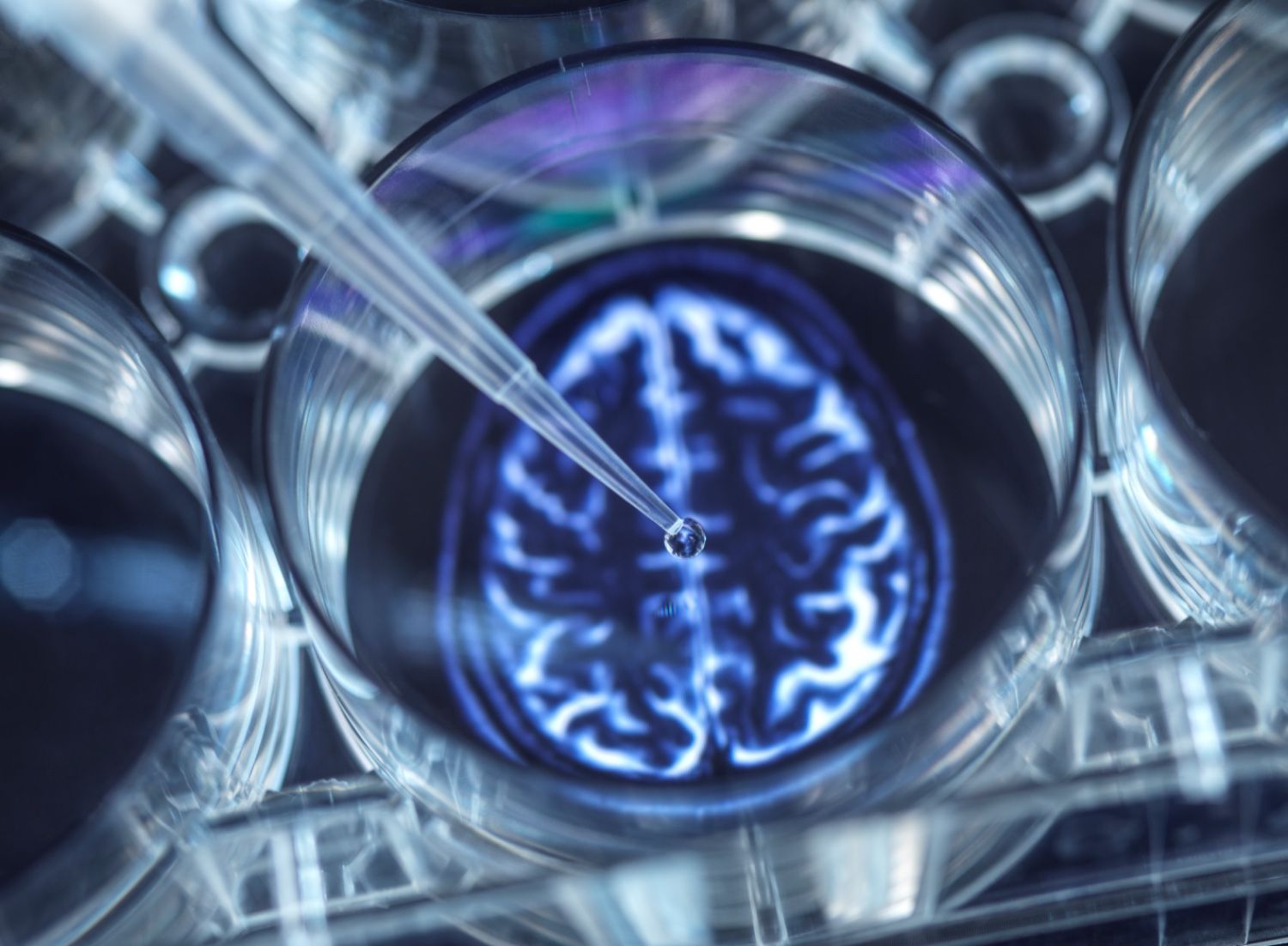 Beyin ve sinir cerrahisi