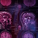 Sinir Sistemi Hastalıkları